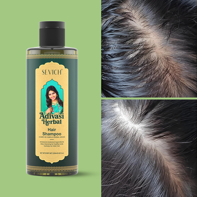 SEVICH Herbal Hair Growth Oil  - Hair Care India ulasan dan harga